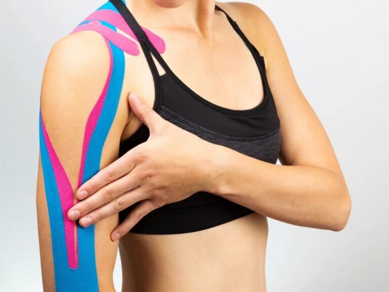Kineziotape je traka koja podupire pokret i oporavak